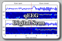 Qeeg Services - qEEG Digital Scans